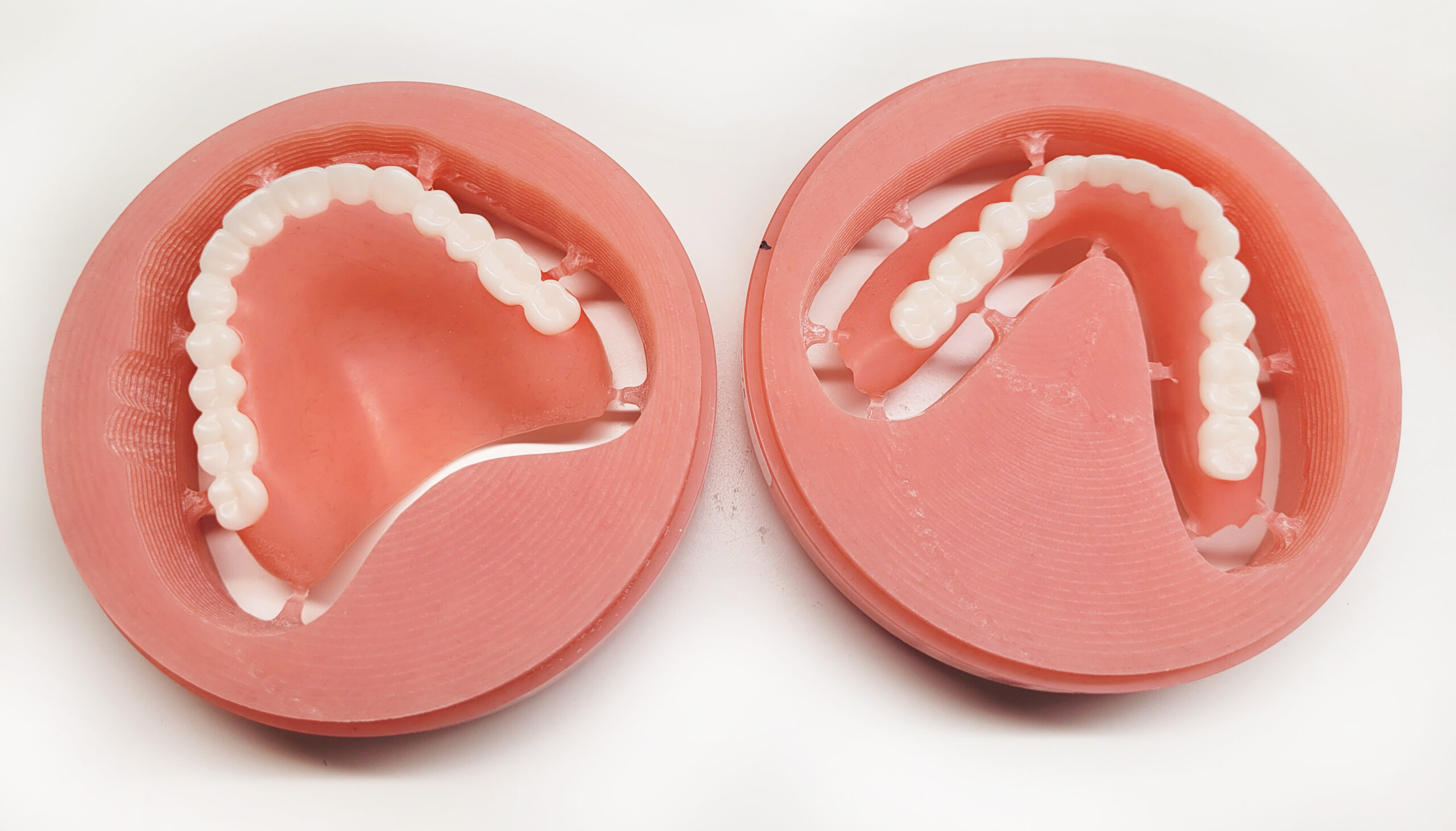 Digital Dentures