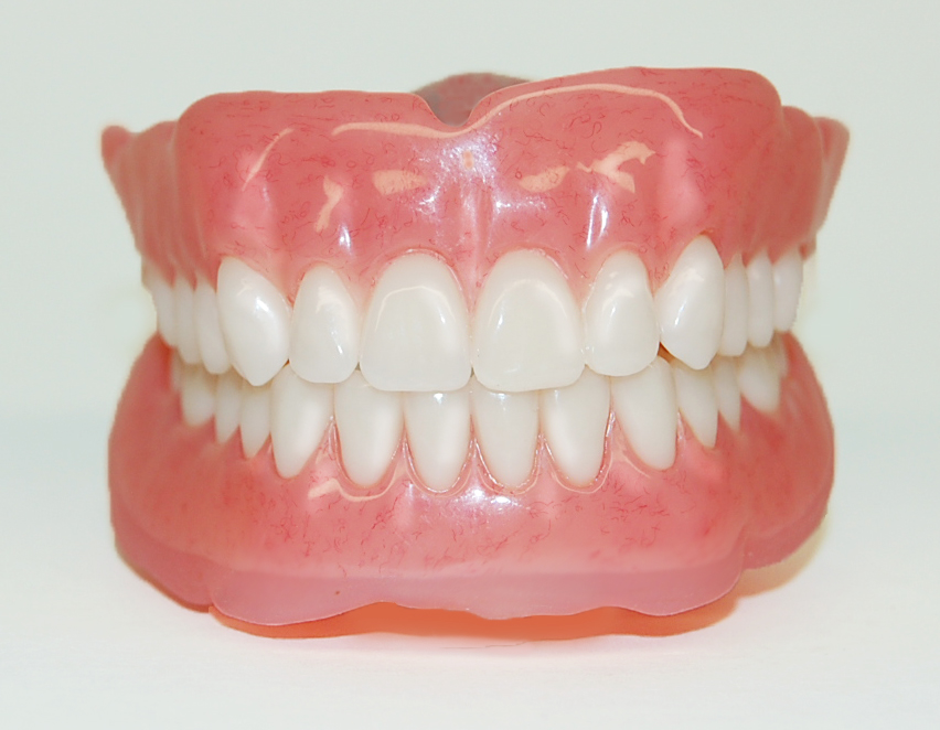 Complete Dentures