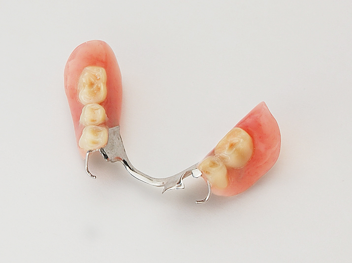 Partial Dentures