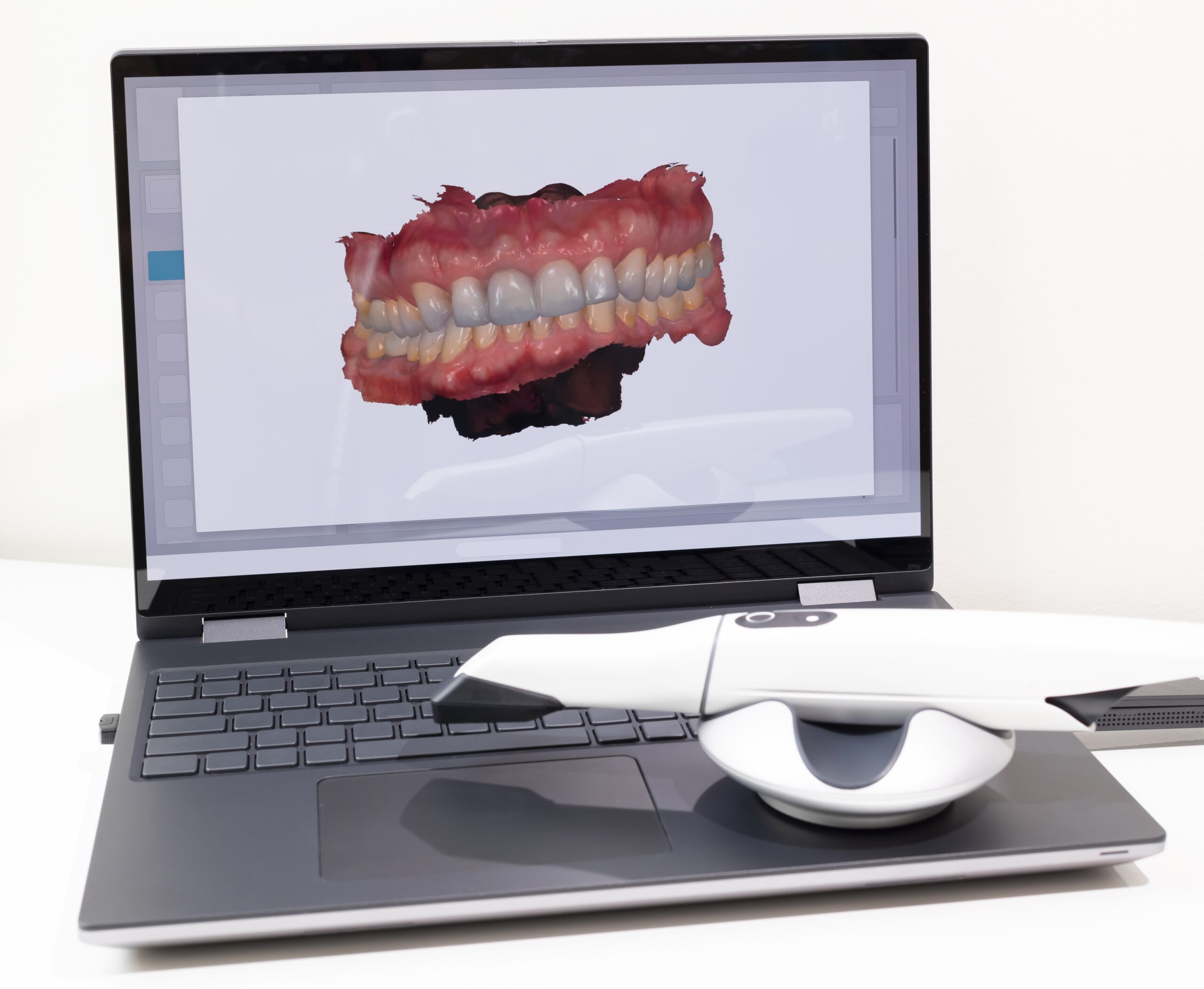 3D Picture of Scanned Teeth on Monitor of Computer, Notebook. White 3d Intraoral Dental Tooth Scanner Lying on Table. Dental Equipment, Device For Scanning Teeth. Copy Space. Vertical Plane.